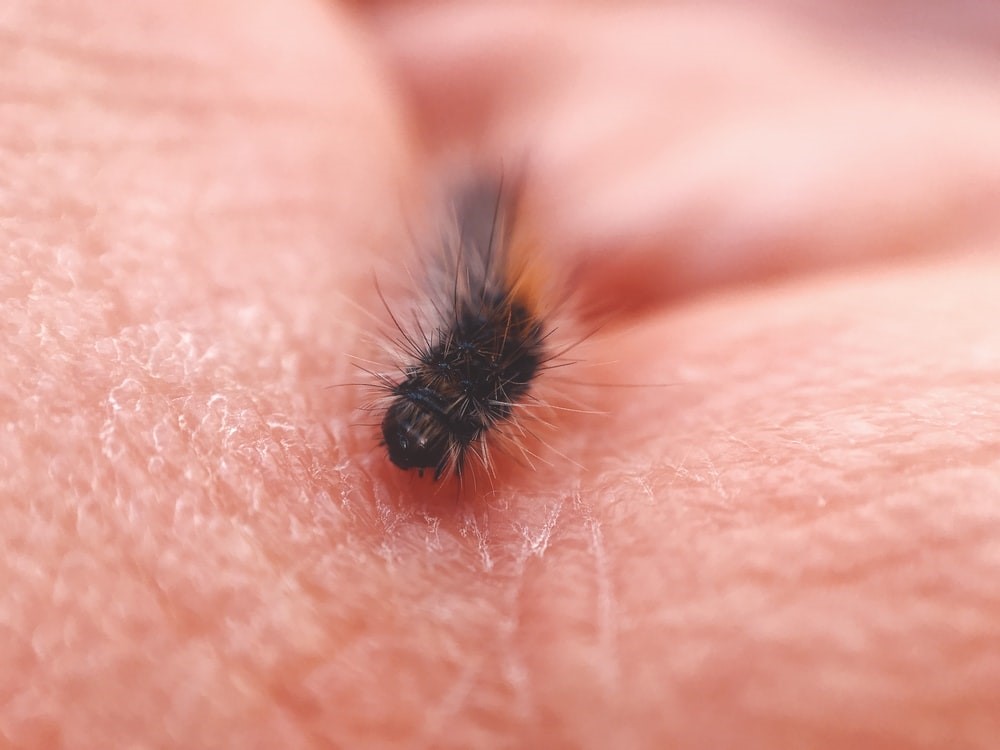 My rabbit has fleas_flea on human skin